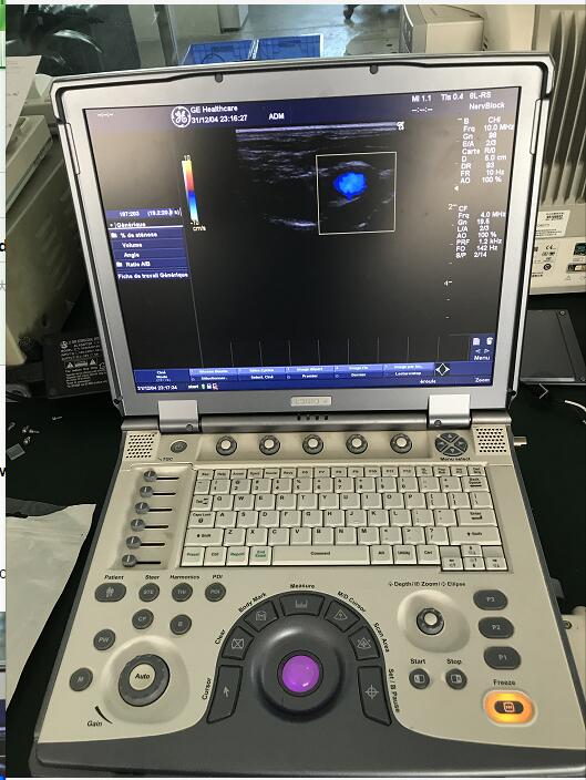 Repair GE Logiq e ultrasound probe