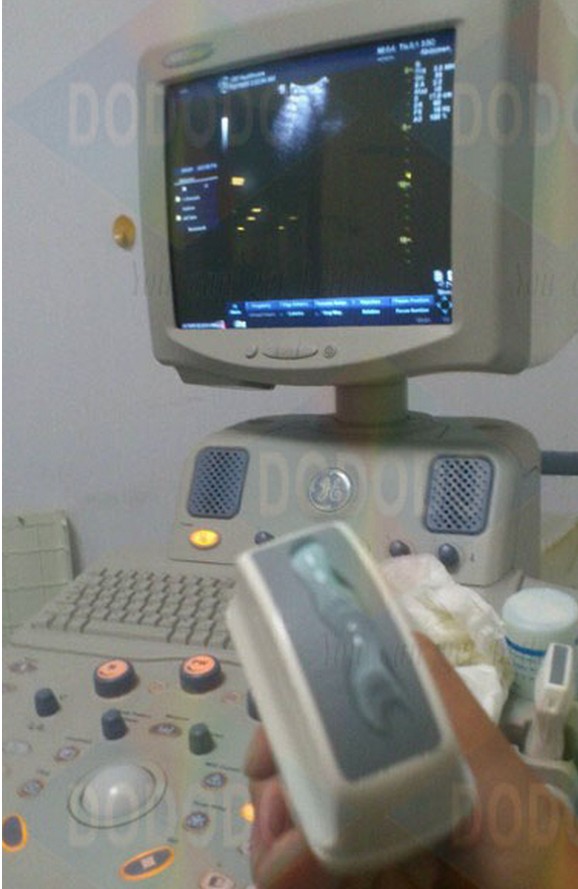 Repair GE LOGIQ3 Ultrasound machine